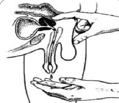 Masaj de prostată pentru a obține un secret