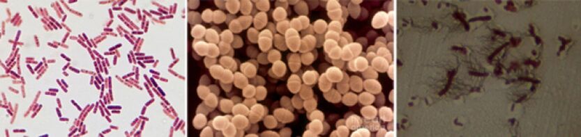 Sticks Escherichia, enterococ fecal și pro - Principalii agenți patogeni ai prostatitei bacteriene cronice