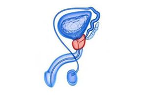 desenul inflamației prostatei