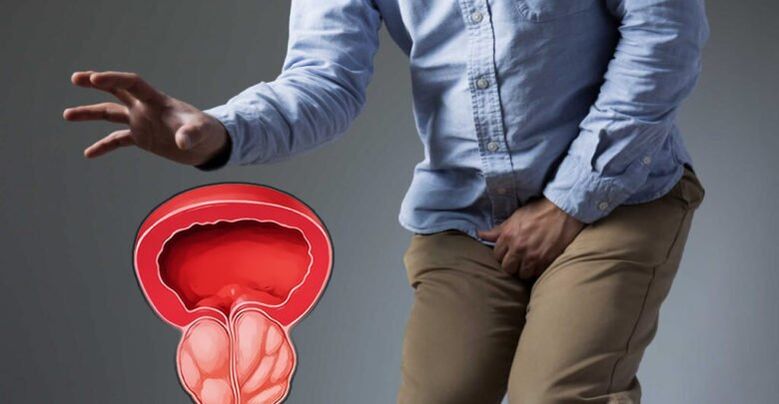Prevenirea prostatitei și a adenomului de prostată